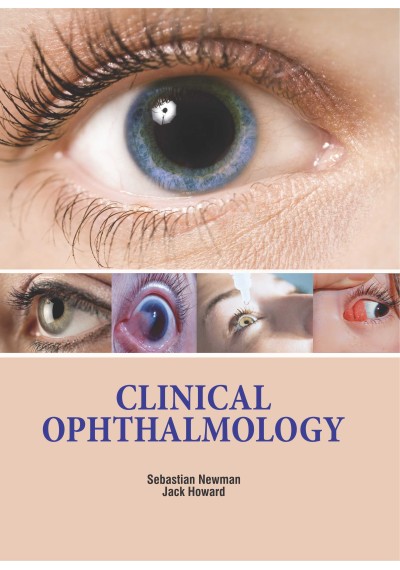 Clinical Ophthalmology