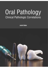 Oral Pathology: Clinical Pathologic Correlations