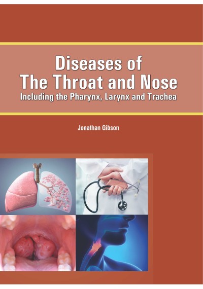 Diseases of the Throat and Nose : Including the Pharynx, Larynx and Trachea