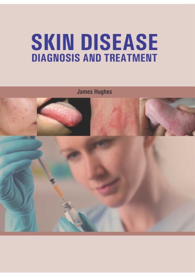 Skin Disease: Diagnosis and Treatment