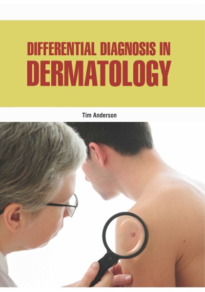 Differential Diagnosis in Dermatology