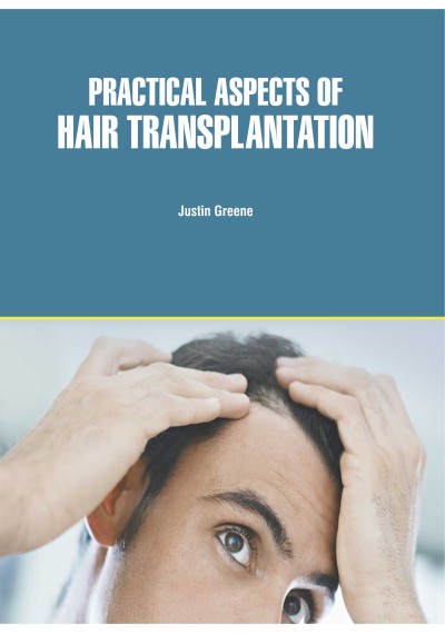 Practical Aspects of Hair Transplantation