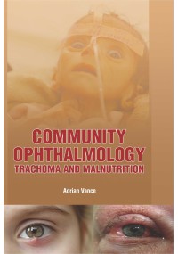 Community Ophthalmology : Trachoma and Malnutrition