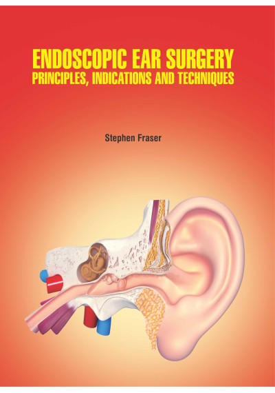 Endoscopic Ear Surgery: Principles, Indications and Techniques