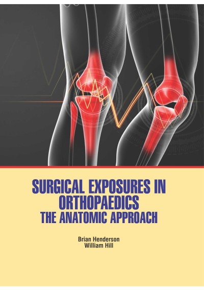 Surgical Exposures in Orthopaedics: The Anatomic Approach