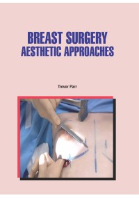 Breast Surgery: Aesthetic Approaches