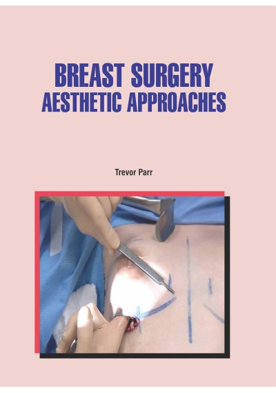 Breast Surgery: Aesthetic Approaches