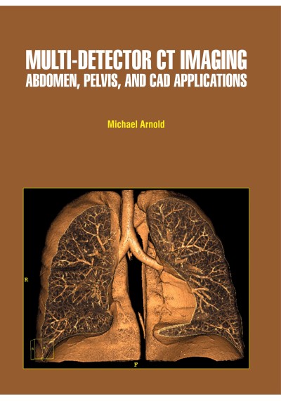 Multi-Detector CT Imaging: Abdomen, Pelvis, and CAD Applications