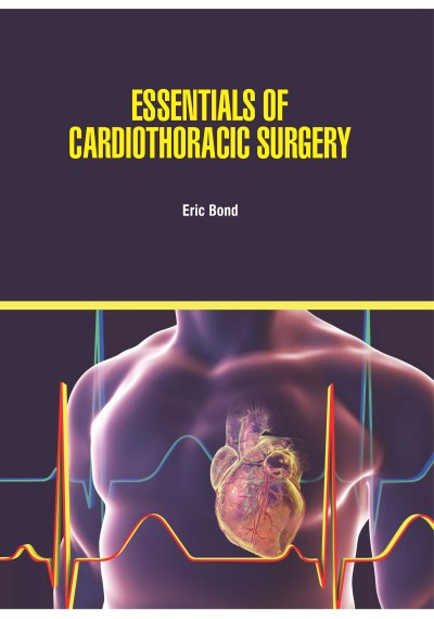 Essentials of Cardiothoracic Surgery