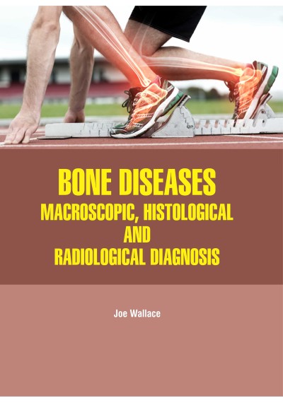 Bone Diseases: Macroscopic, Histological and Radiological Diagnosis